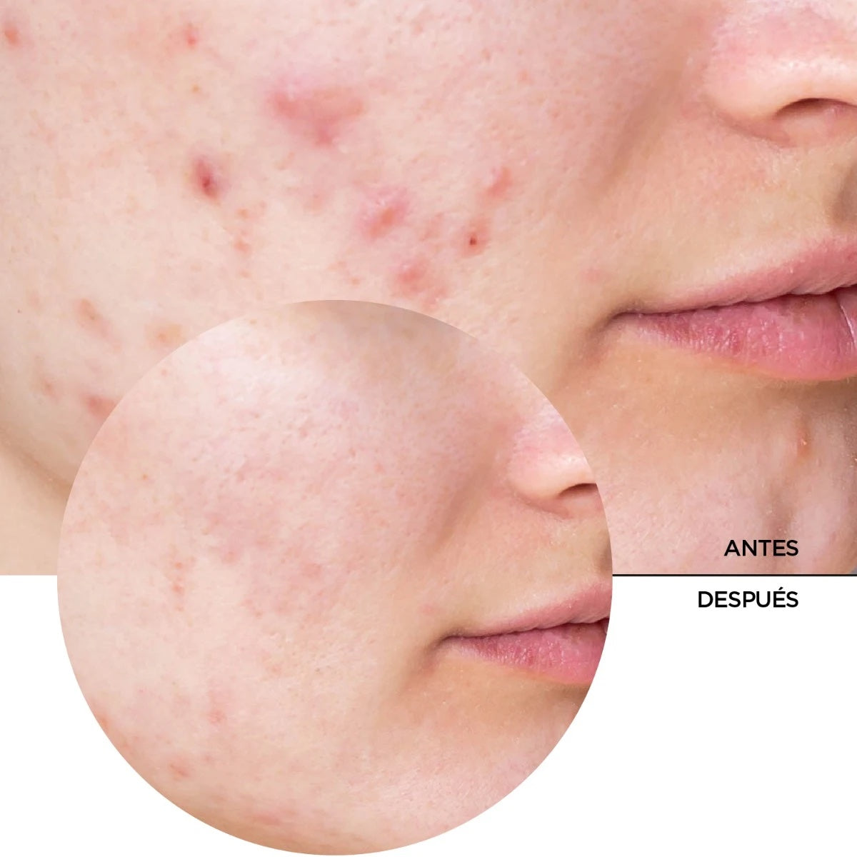 REVOX B77 Niacinamida 10% - Just Niacinamide 10% 30 Ml