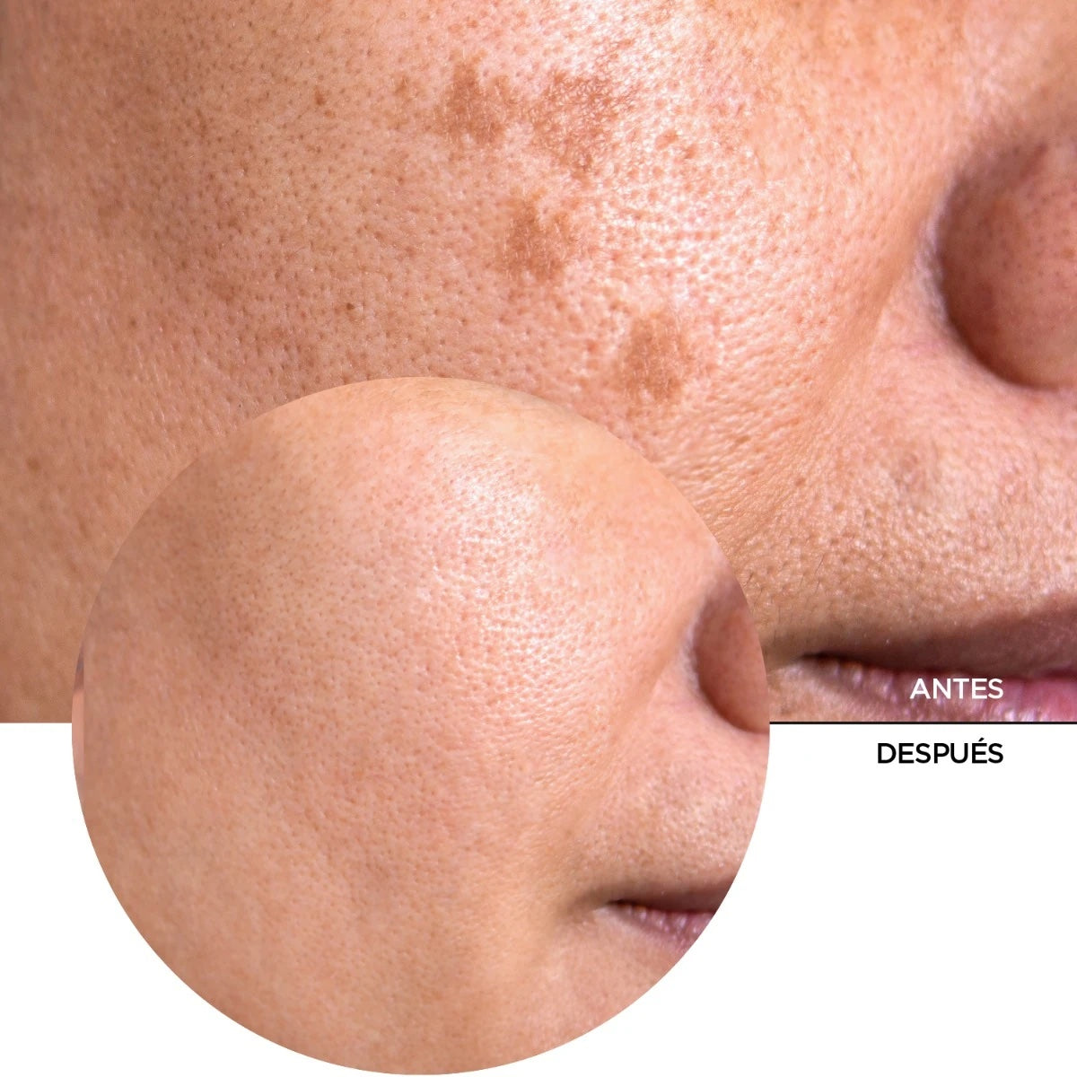 REVOX Vitamina C 20% - Just Vitamin C 20% 30 Ml